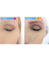 Formação Microblanding